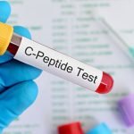 C peptide چیست, کاربرد های آزمایش سی پپتید, عوارض انجام آزمایش C-Peptide