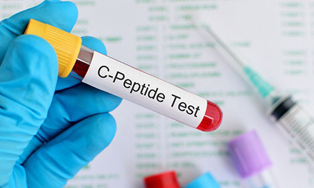 C-Peptide در آزمایش خون C peptide چیست, کاربرد های آزمایش سی پپتید, عوارض انجام آزمایش C-Peptide