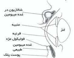 شالازیون, درمان شالازیون, گل‌مژه چیست
