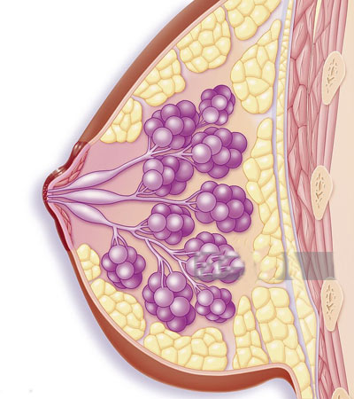 علل ترشح مایع از نوک سینه ترشحات پستان,ترشحات سینه,علل ترشحات نوک سینه