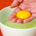 درمان معجزه آمیز سوختگی
