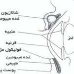 شالازیون, درمان شالازیون, گل‌مژه چیست