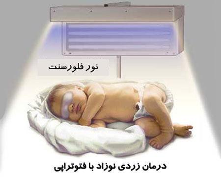 پیشگیری از زردی,بیماری های کبدی پیشگیری از زردی,بیماری های کبدی
