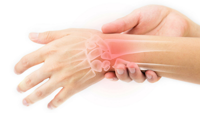 علل روماتیسم مفصلی, آرتریت روماتوئید