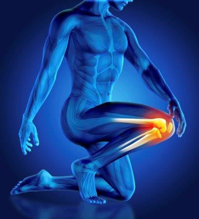 علل روماتیسم مفصلی, آرتریت روماتوئید