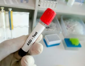 آزمایش aso, آزمایش aso titer
