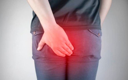 پماد برای درمان خارش مقعدی کودکان