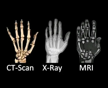 مقایسه جامع اشعه ایکس ام‌آرآی و سی‌تی‌اسکن, تفاوت ام آر آی و سی تی اسکن