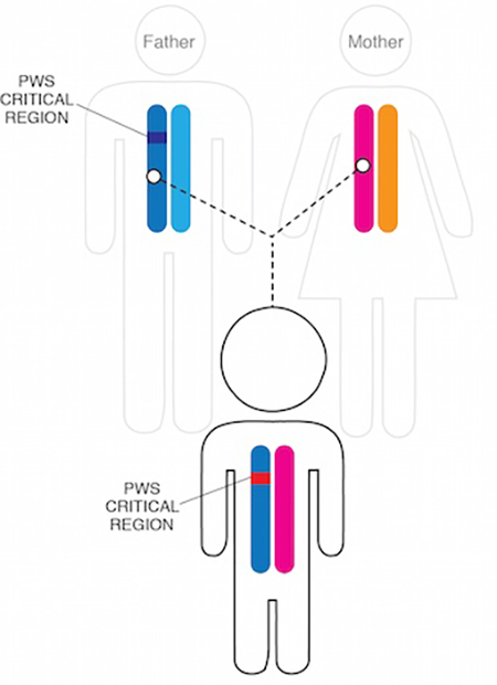 سندرم پرادر-ویلی چیست, مشکلات ژنتیکی پرادر-ویلی