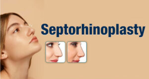 سپتورینوپلاستی چیست, سپتورینوپلاستی برای انحراف بینی